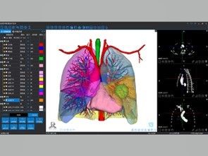 Медицинская 3D-реконструкция и 3D-печать